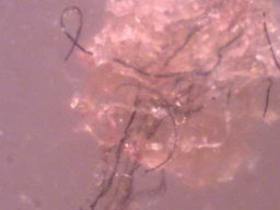 Chemtrail paraziták morgellonok.
